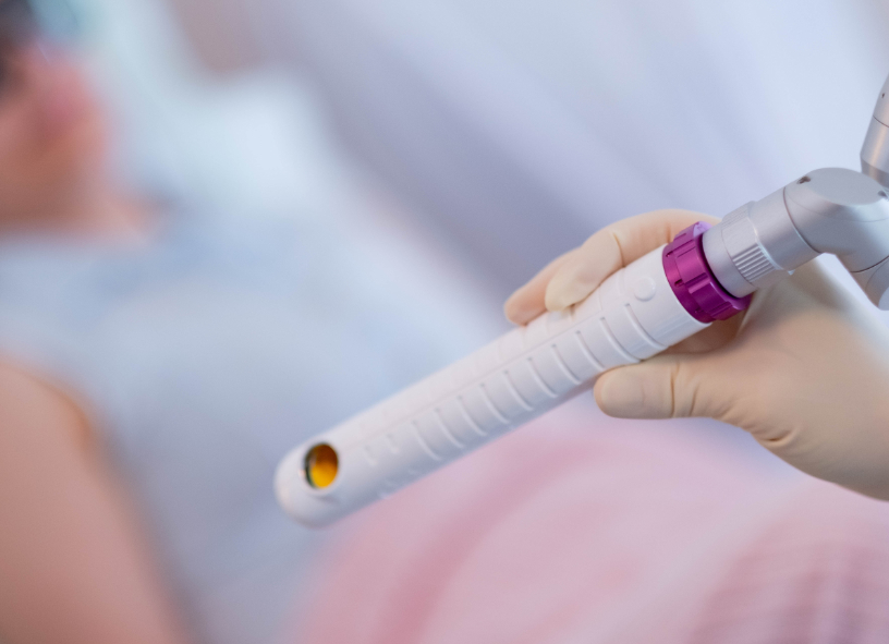 Laser-Handstück während einer sanften Behandlung der Intimgesundheit